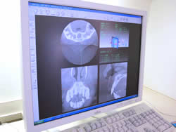 CT画像処理ソフト写真